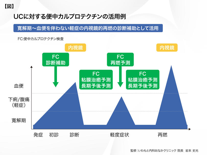 いわもと内科おなかクリニック_岩本先生_図表.jpg